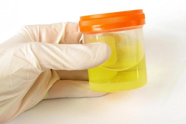 Synthetic Urine Heating Pad Pennfield High Point NC